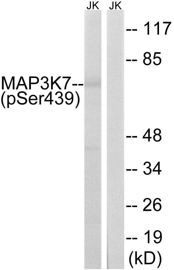MAP3K7 / TAK1 Antibody (phospho-Ser439)