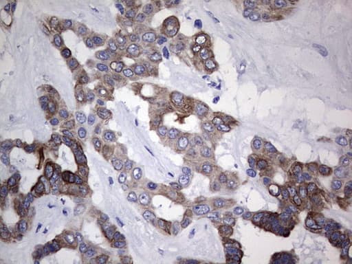 KRT19 / CK19 / Cytokeratin 19 Antibody (aa240-390, clone OTI8D1)