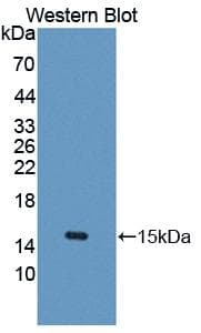 UBAP2 Antibody (aa1-104, PE)
