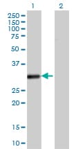 VDAC2 Antibody (clone 3D2)
