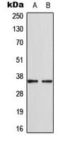 Polyclonal Rabbit anti-Human CDKL4 Antibody (C-Terminus, IHC, IF, WB)
