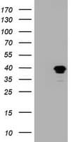 MAGEB1 Antibody (clone OTI5C12)