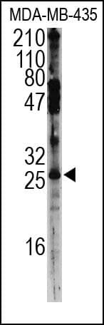 Polyclonal Rabbit anti-Human SNAI2 / SLUG Antibody (WB)