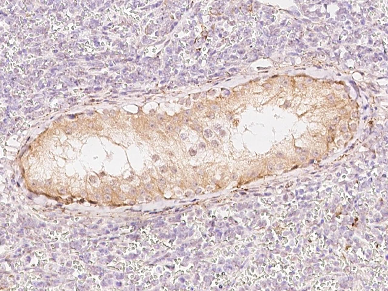 SPATA20 Antibody
