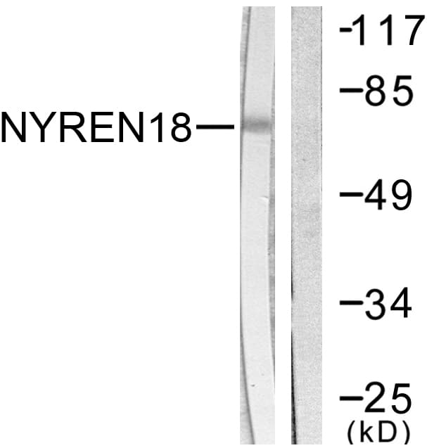 Polyclonal Rabbit anti-Human NUB1 Antibody (aa566-615, IHC, WB)