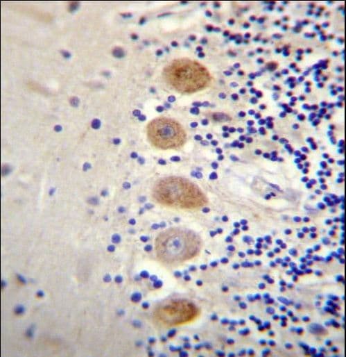 ADGRF2 / GPR111 Antibody (aa366-393)