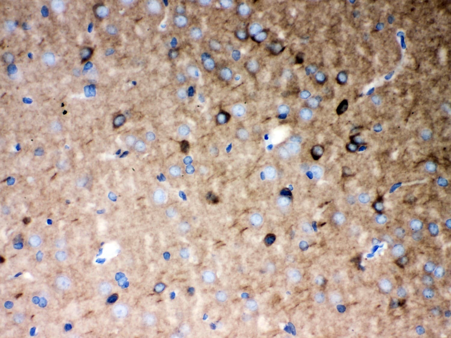 Polyclonal Rabbit anti-Human P2RX5 / P2X5 Antibody (aa333-422, IHC, WB)