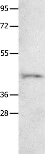 NTSR1 / NTR Antibody
