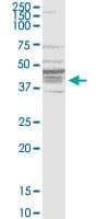 B1R / BDKRB1 Antibody (clone 3A2)