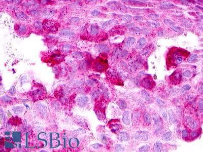 PathPlus™ XCR1 Antibody (Extracellular Domain)