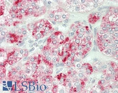 IHC-plus™ SGSH Antibody (aa420-449)