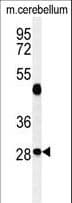 Polyclonal Rabbit anti-Human RRAGD Antibody (aa171-199, IHC, WB)