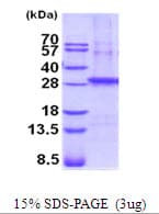 Human SGCB / SGC / Sarcoglycan Beta Protein (Recombinant His)