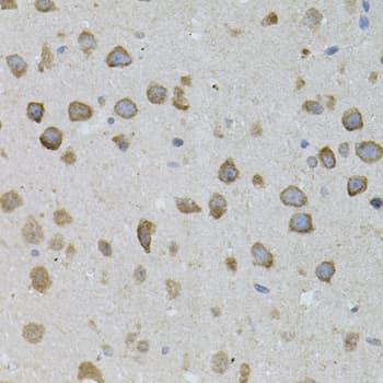 ASAH2 Antibody