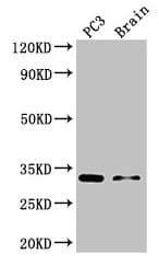 Polyclonal Rabbit anti-Human HOXB13 Antibody (WB)