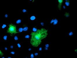 IHC-plus™ Monoclonal Mouse anti-Human VWA5A Antibody (clone 3A3, IHC, IF, WB)