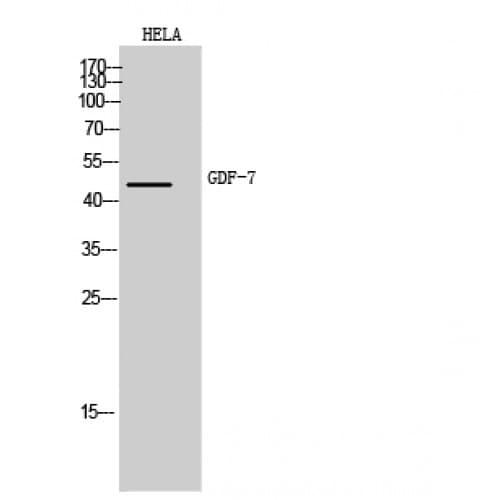 Polyclonal Rabbit anti-Human BMP12 / GDF7 Antibody (321-370 aa, Internal, IHC, WB)