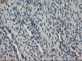STK39 / SPAK Antibody (clone OTI4E3)