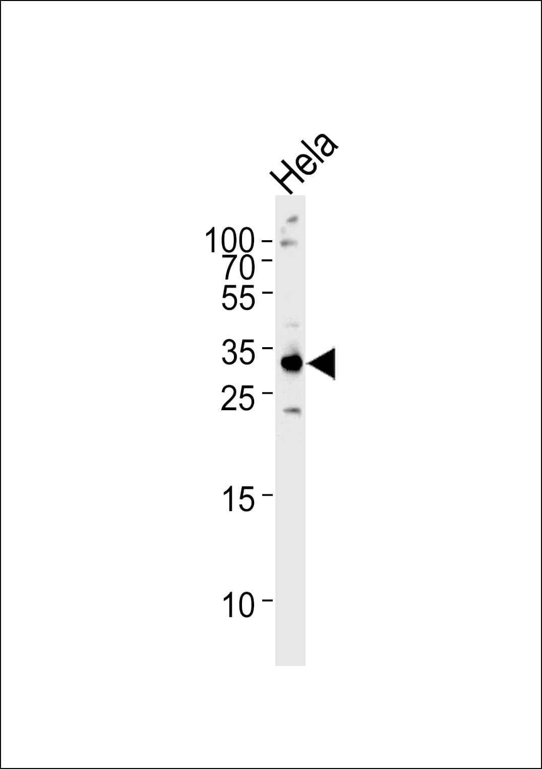 RPS6 / Ribosomal Protein S6 Antibody (aa1-30)