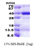 Human HLA-C Protein (Recombinant His)