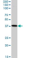 IHC-plus™ BAG1 / BAG-1 Antibody (clone 2D3)