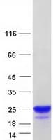 Human EFCC1 Protein (Recombinant Myc-DDK (Flag))