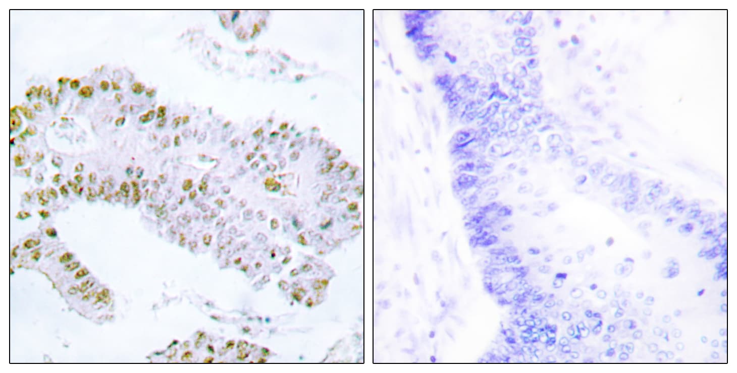 ERF / PE2 Antibody (aa492-541)