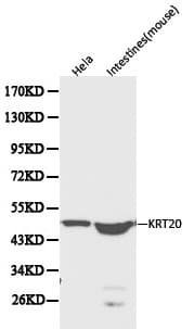 PathPlus™ Polyclonal Rabbit anti-Human KRT20 / CK20 / Cytokeratin 20 Antibody (IHC, WB)