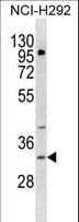 TREML1 / TLT1 Antibody (aa215-241)