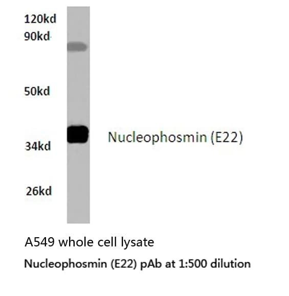Polyclonal Rabbit anti-Human NPM1 / NPM / Nucleophosmin Antibody (Glu22, IHC, WB)