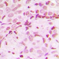 IHC-plus™ Treacle / TCOF1 Antibody (N-Terminus)