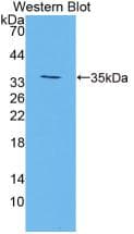TGM3 / Transglutaminase 3 Antibody (aa468-693)