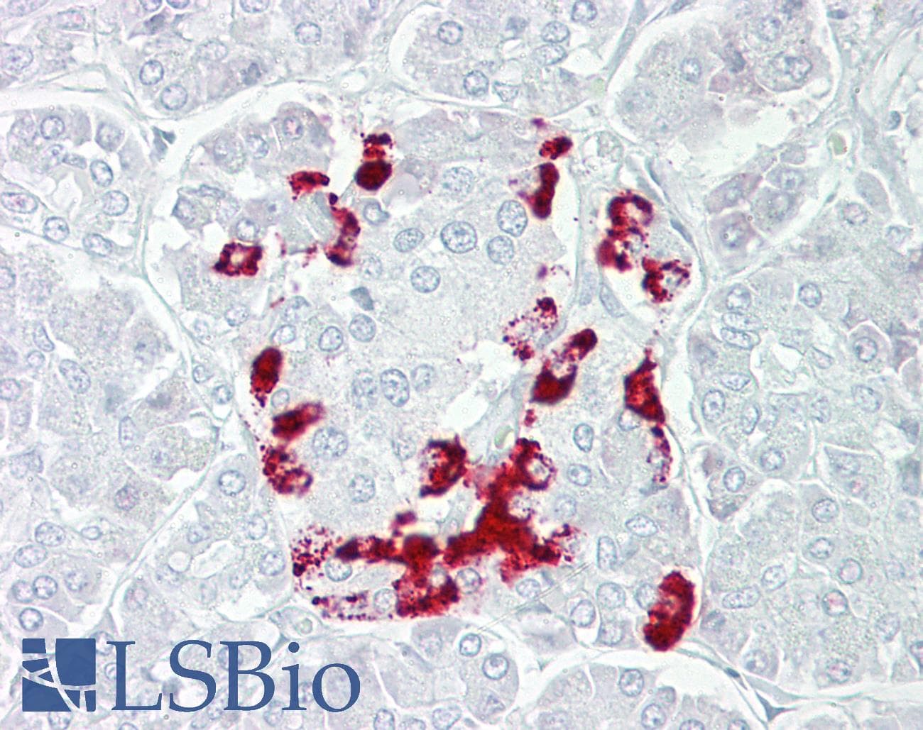 Polyclonal Rabbit anti-Human SSTR1 Antibody (aa251-300, IHC, WB)