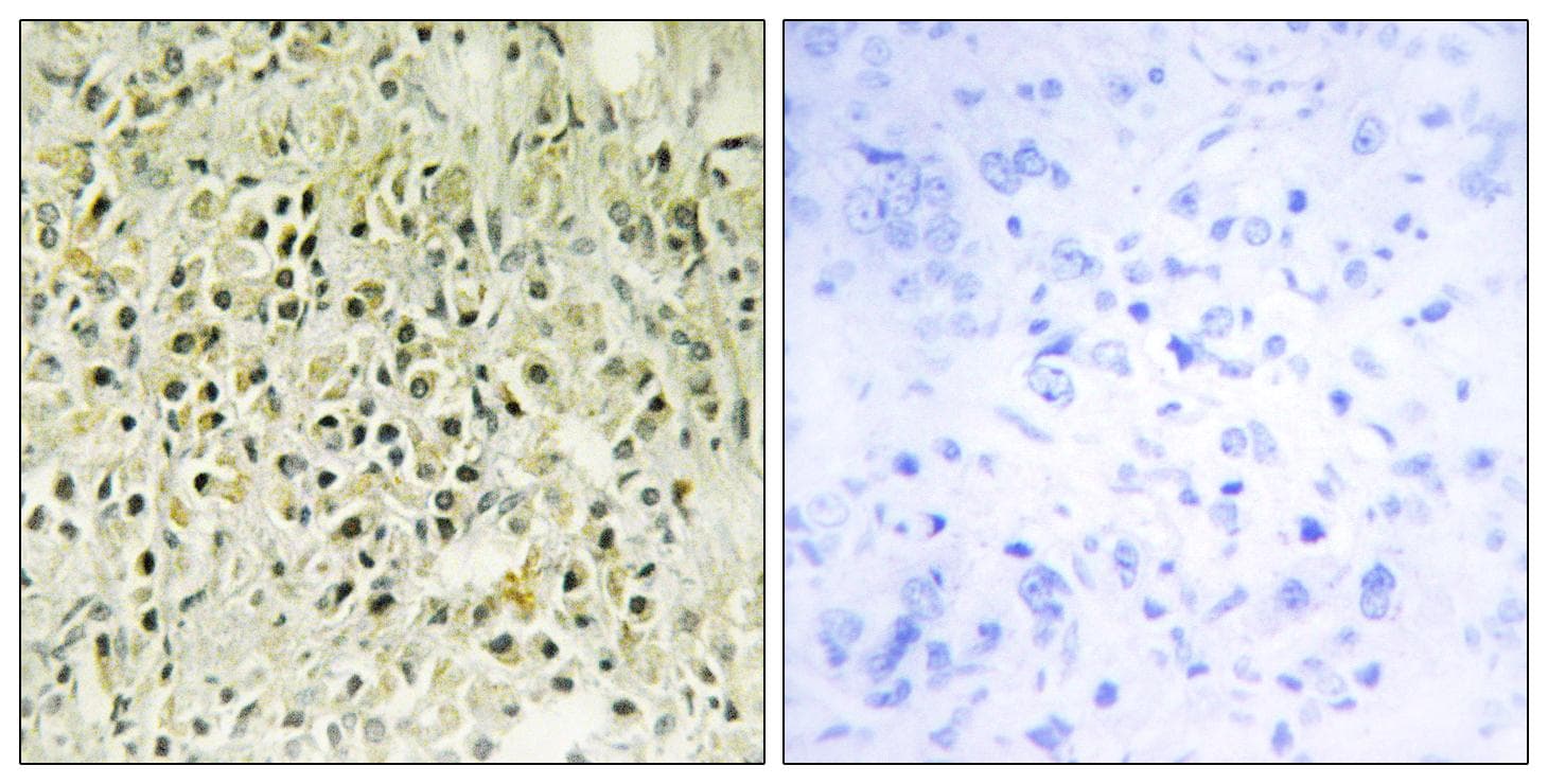 LGALS8 / Galectin 8 Antibody