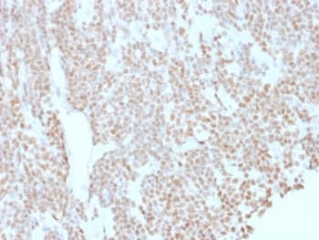 BCL6 Antibody (clone BCL6/1527)