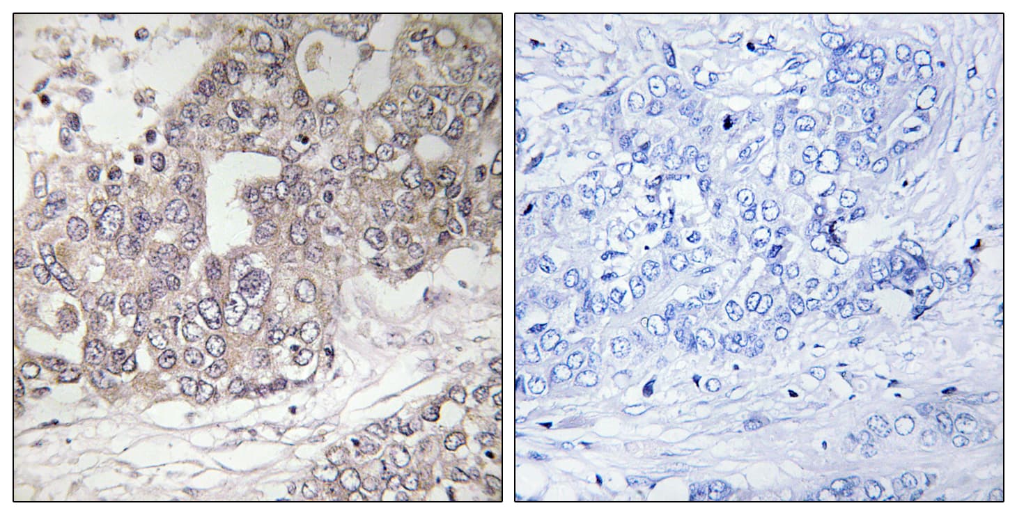 AUTL1 / ATG4C Antibody (aa21-70)