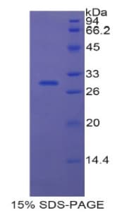Human ETFA Protein (Recombinant His-T7)
