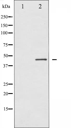 Polyclonal Rabbit anti-Human RPS6KB2 / S6K2 Antibody (IF, WB)