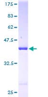Human ARF6 Protein (Recombinant GST)