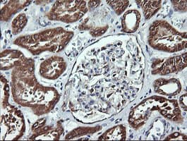 ACAA2 Antibody (clone OTI2G6)