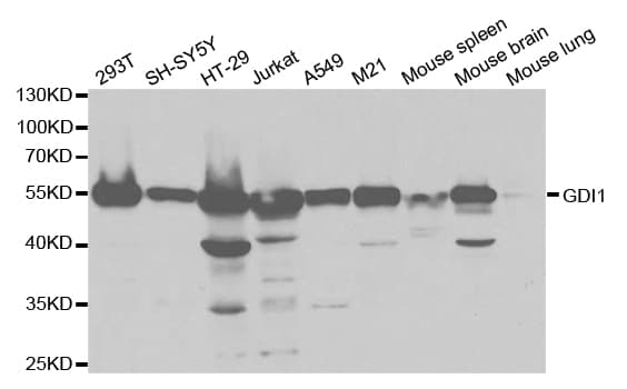 IHC-plus™ GDI1 Antibody