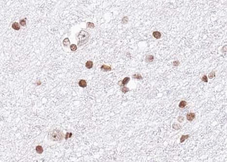 HNRPA1 / HnRNP A1 Antibody