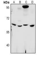 Polyclonal Rabbit anti-Human WEE1B / WEE2 Antibody (WB)
