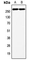 F8 / FVIII / Factor VIII Antibody (C-Terminus)