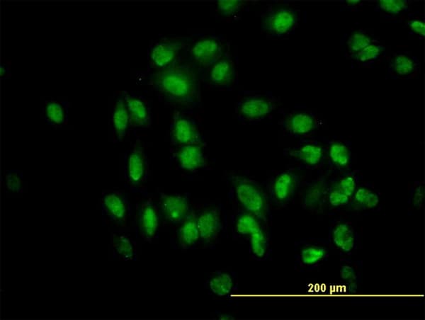 TULP2 Antibody (clone 2B5)