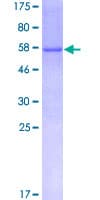 Human NNT Protein (Recombinant GST)