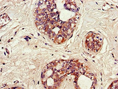 Polyclonal Rabbit anti-Human SNX17 Antibody (IHC, IF, WB)