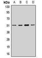RARA / RAR Alpha Antibody