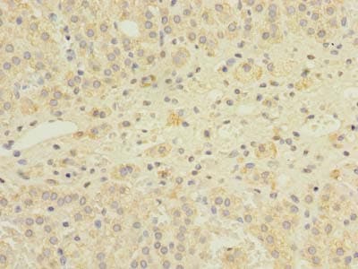 GEMIN8 Antibody