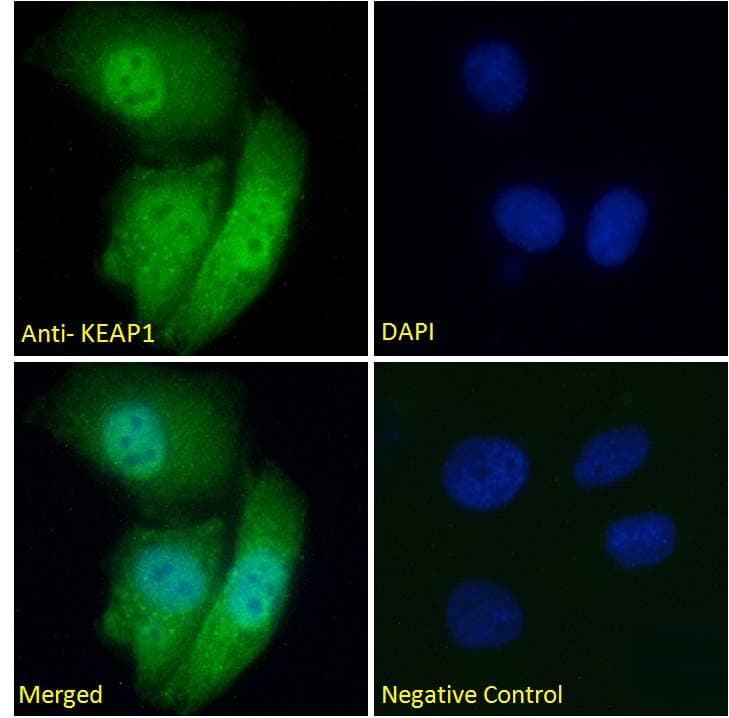 IHC-plus™ KEAP1 Antibody (aa41-53)